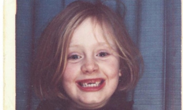 Adele sún răng được dùng làm bìa cho single mới